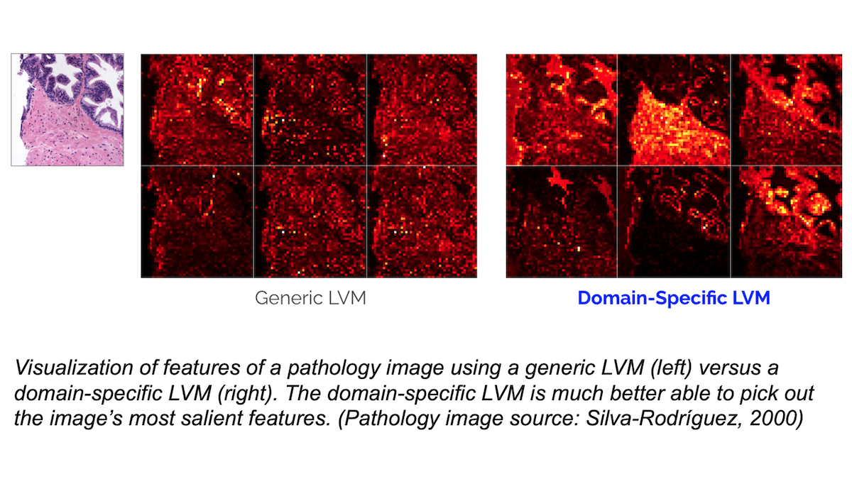 Visualization of features of a pathology image using a generic LVM (left) versus a domain-specific LVM (right)
